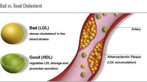 Transport of Cholesterol 17 The job of lipoproteins 5 major groups - chylomicron, VLDL, IDL, LDL, and HDL (lg to sm) Taken to liver via bloodstream as chylomicrons Packaged into other forms of