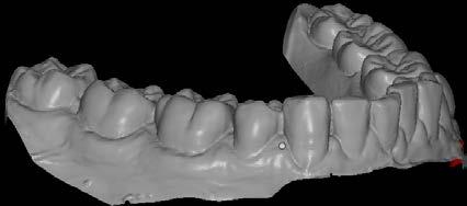 EXTENSIONS Images 5.0mm e) Teeth and soft tissue to 5.