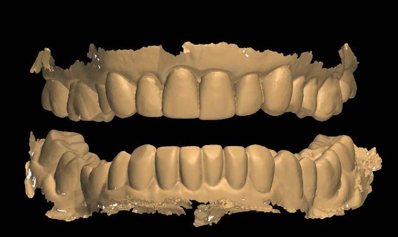 EXTENSIONS Images e) Teeth and soft tissue to 5.