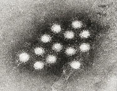Pathogenic Organisms: Viruses Viruses: infectious and reproduce only within living host cells.