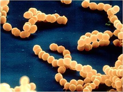 Streptococcus(gram positive