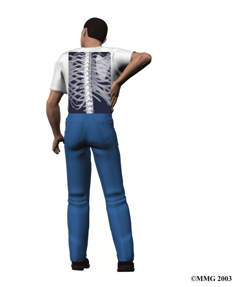 A Patient s Guide to Lumbar