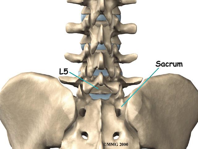 This guide will help you understand how the problem develops how doctors diagnose the condition what treatment options are available Anatomy What parts of the spine are involved?