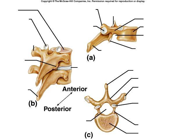 5. Identify the two differences between the epiphyseal plate and an intervertebral disc, and identify each in the diagrams below.