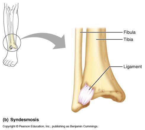 Fibrous joints Syndemoses Bones connected by