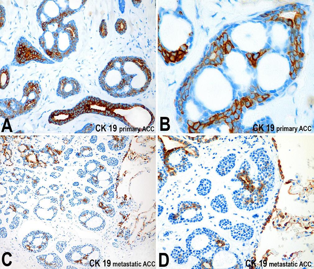 Immunohistochemistry revealed with DAB (all figures 200X). Figure 6.