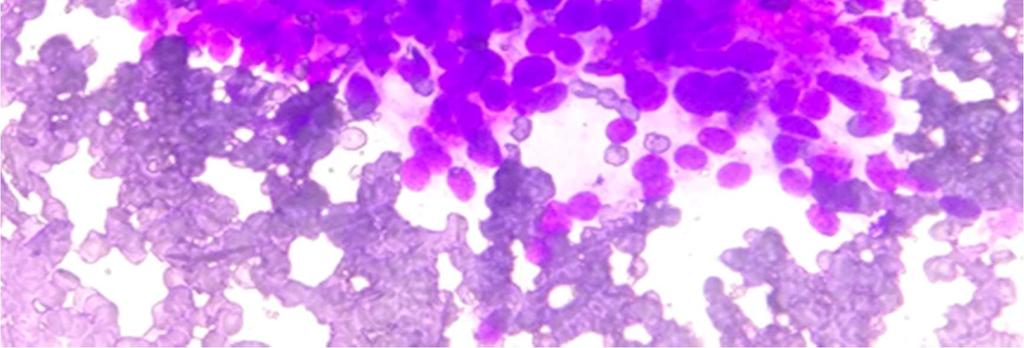 On correlating the cytological diagnosis with histopathological diagnosis of the received