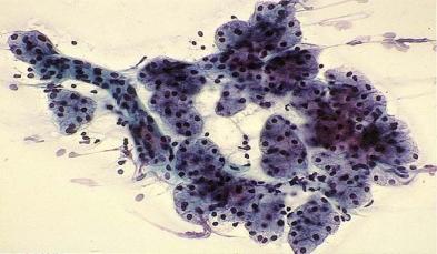 FNA OF THE NORMAL SALIVARY GLAND Cytologic Features of the Normal
