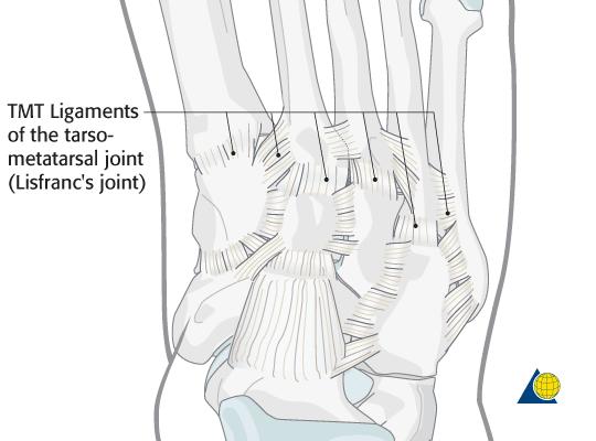 The Lisfranc / tarsometatarsal (TMT) articulation is very strong. The base of the second metatarsal is held in place by the plantar TMT ligaments.