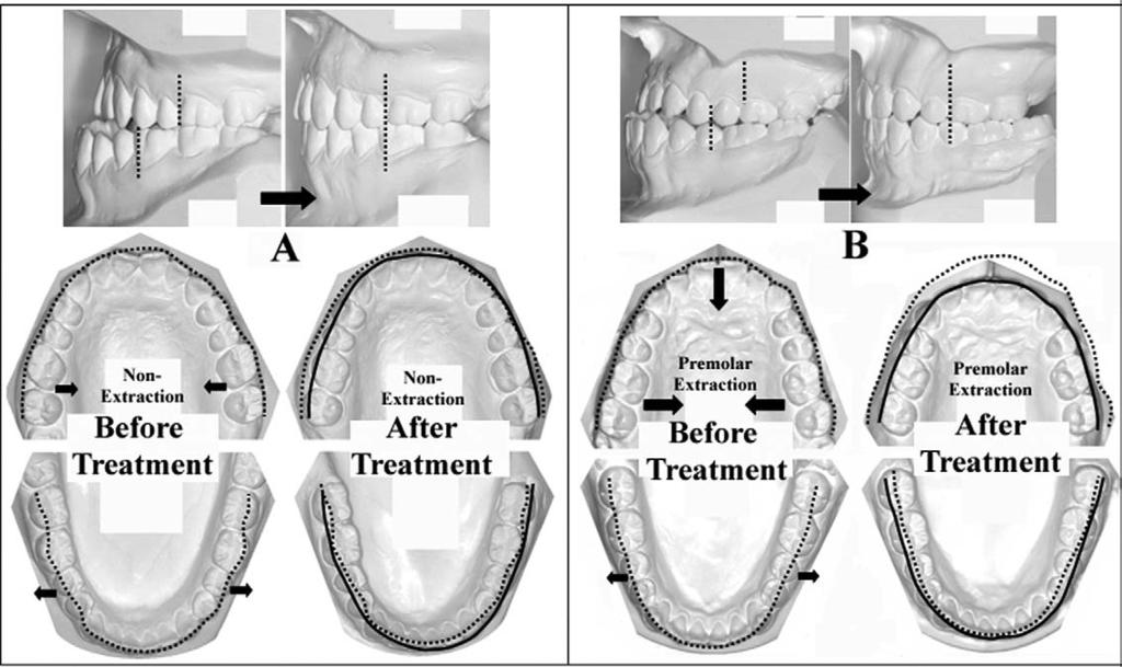 American Journal of Orthodontics and Dentofacial Orthopedics Volume 129, Number 6 Lee, Kim, and Nahm 743 Fig 2.