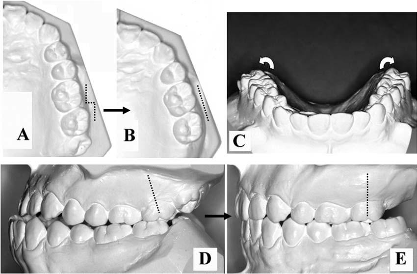 American Journal of Orthodontics and Dentofacial Orthopedics Volume 129, Number 6 Lee, Kim, and Nahm 745 Table II.