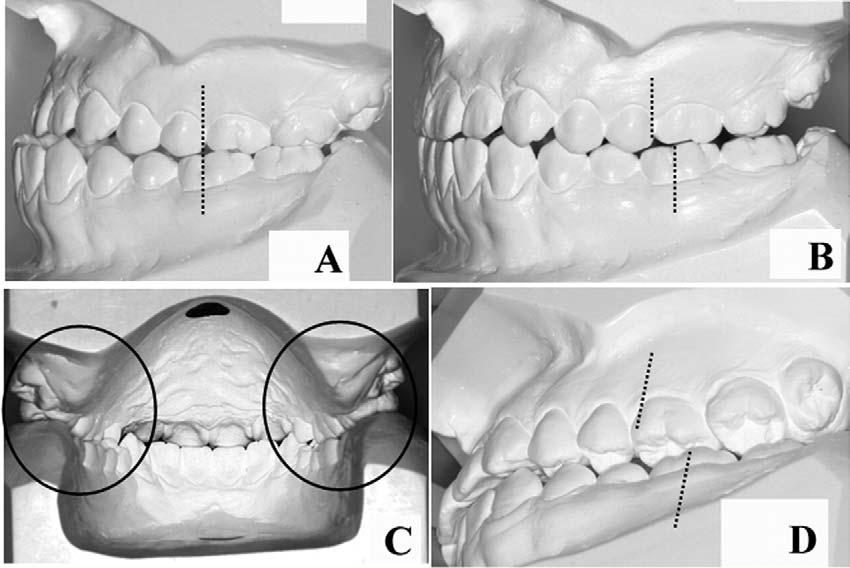 American Journal of Orthodontics and Dentofacial Orthopedics Volume 129, Number 6 Lee, Kim, and Nahm 747 Fig 5.