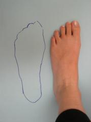 2. Regular podiatry review It is important that regular podiatry review is part of the foot protection program.