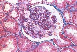 cells Glomerulus fenestrated capillaries podocytes
