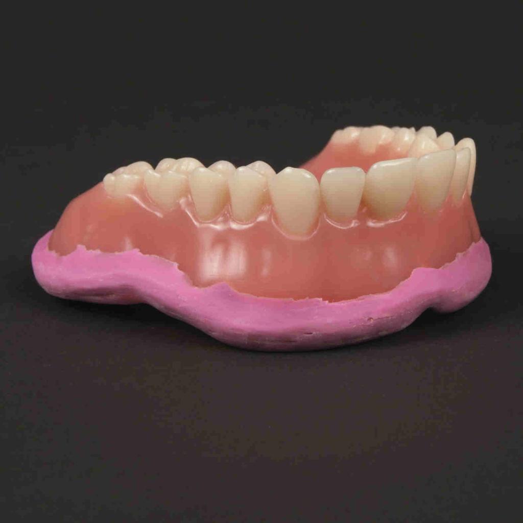 If the denture does not have a form-fit on the gingiva, it will be necessary to reline the denture to ensure proper