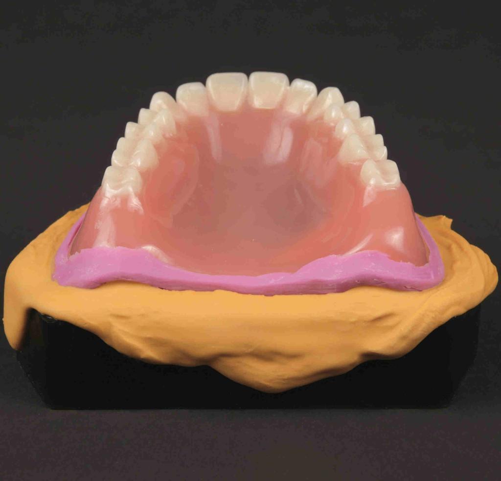 To reline the denture, use the existing denture as an impression tray to prepare an impression of the current