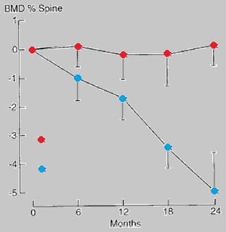 Levothyroxine therapy & bone damage: YES, BUT No change in the mean bone mineral density of women after 1 yr of l-t4 therapy for benign solitary thyroid nodules (mean TSH < 0.3 miu/liter).