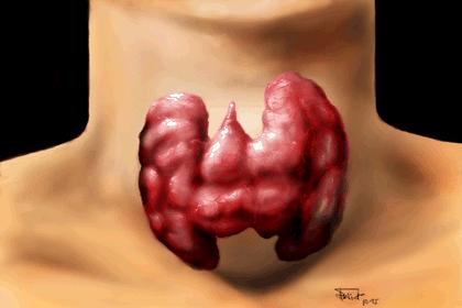 Thyroid & Brain