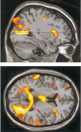 Parietal/occipital area