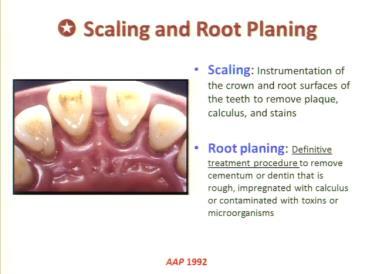 Doesn t say supra or subgingival Root planing is more definitive procedure than scaling.