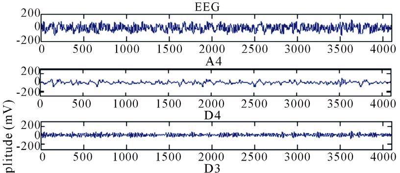 Figures 4(a), (c), (e) show the EEG data recorded from a typical healthy,