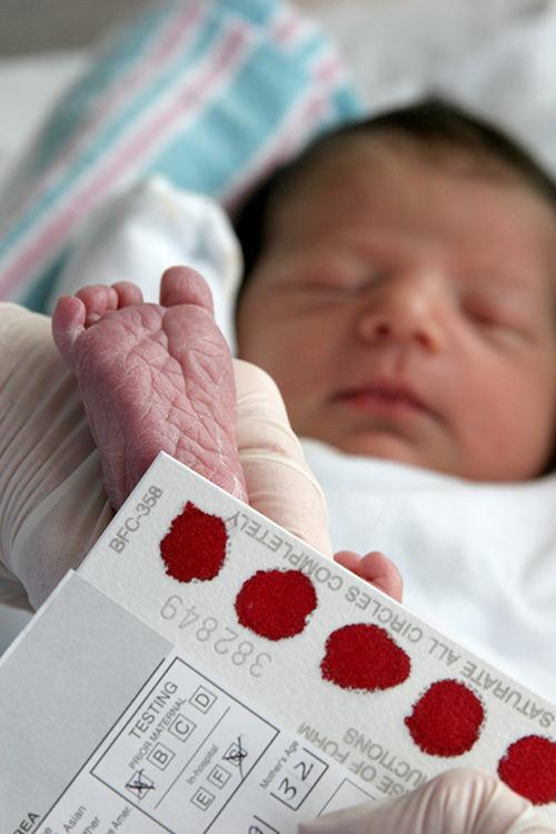 Newborn Screening (NBS) the Best Practice of Preventive Medicine NBS