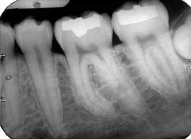 Then boundaries of each region are matched with the horizontal and vertical boundaries in the radiograph image.