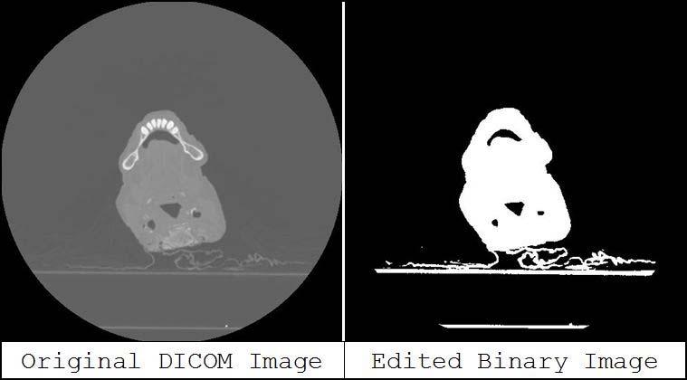 Image Processing Attached is a set of original CT scan images, a set of edited binary images and the MATLAB code used to create the edited images.