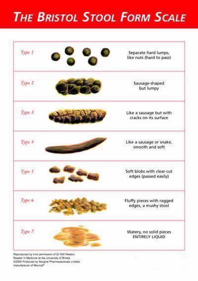 Figure 3 Bristol Stool Chart Preventing constipation in the elderly. The main way to combat constipation is through preventive measures.