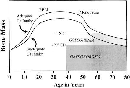 OSTEOPOROSIS PREVENTION STARTS IN YOUTH