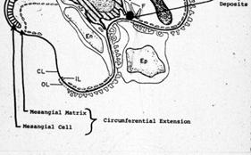 Extracapillary (crescentic) Mechanisms of Immunologic Injury to the Glomerulus 1. Glomerular deposition of circulating Ag-Ab complexes 2.