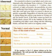 : Screening Early identification important to outcome Screening Bile acids in dried blood spots (US) Conjugated bilirubin between 6-10 days of age (UK) Stool color charts (Taiwan) sensitivity and