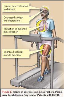 Exercise training is the cornerstone of any rehabilitation programme Casaburi &
