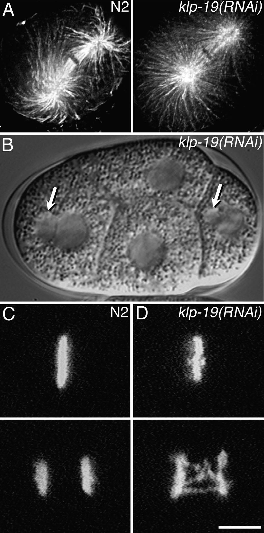 Polar ejection force in C. elegans Powers et al. 995 Figure 4. KLP-19 depletion causes chromosome segregation defects.