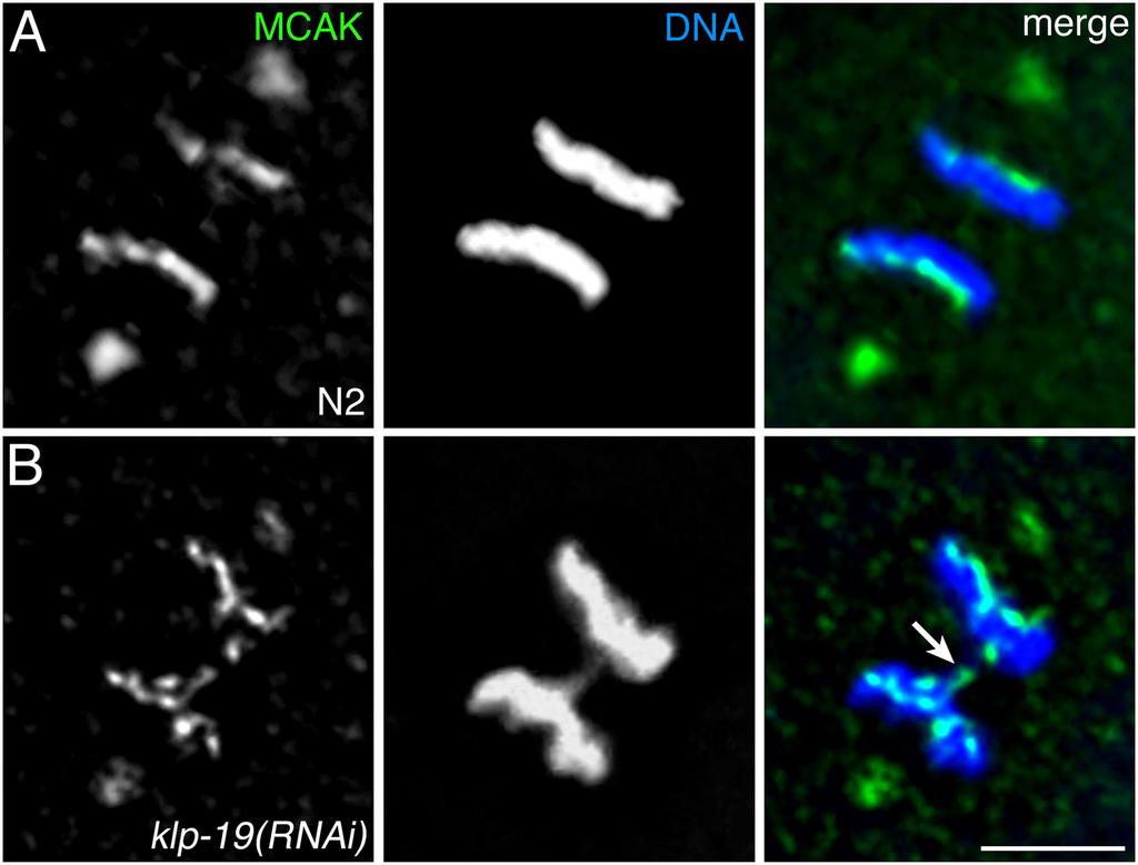 (B) A Nomarski DIC image of a live klp-19(rnai) four-cell embryo. Micronuclei (arrows) are visible in two cells.