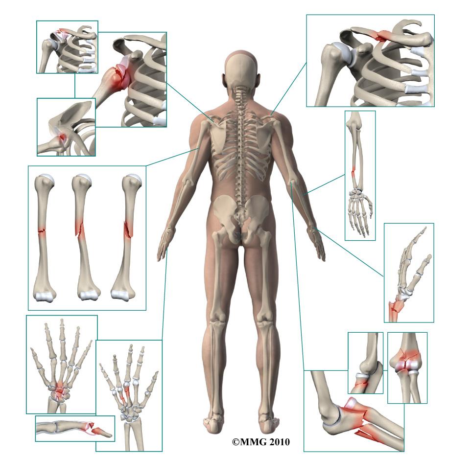 A Patient s Guide to Adult Forearm