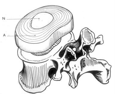 (fibrocartilage) Nucleus pulposus (remnant of notochord)