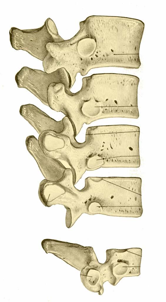 LATERAL VIEW OF THORACIC VERTEBRA Spines inclined Inf. post ant 3. Costal Facets for Ribs - Body - Facets for Heads of rib Transverse Process - Facets for Tubercles of ribs 4.