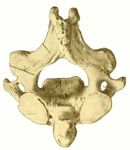 FIRST CERVICAL VERTEBRA = C1 (ATLAS) LATERAL MASS ANTERIOR ARCH POSTERIOR ARCH Ant. tubercle Post.