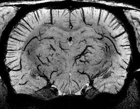T 2 *-weighted images of rat brain (no