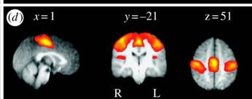 Resting state fmri Task-free or resting