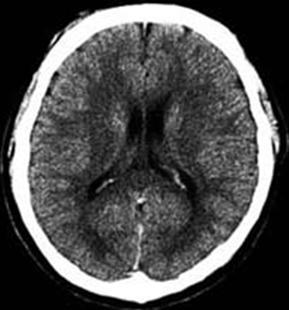 Imaging brain structure in vivo MRI MRI MRI CT PET with specific tracers (i.e. 18Fflumazenil) http://thebrain.