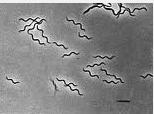 , with little evidence, that it was transmitted Ixodes ricinus and caused by a spirochete i.e. a borrelia species Considered heresy because spirochetes were carried by soft not hard ticks Willie Burgdorfer s Discovery 1951 hired by Dr.