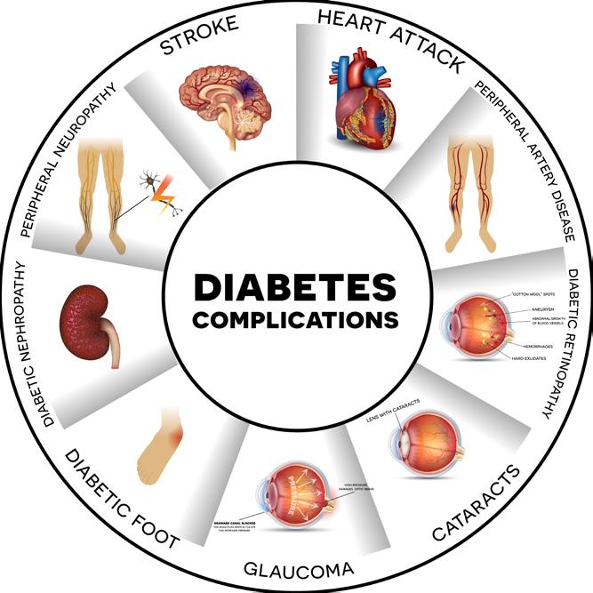 Chapter 4: Endocrine, Nutritional & Metabolic Diseases Coma, hyperglycemic (diabetic) see Diabetes,