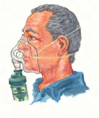 Preventing Your Symptoms and Taking Your Medications The nebulizer This is a small machine which changes liquid medication into fine droplets which are inhaled through a mask.