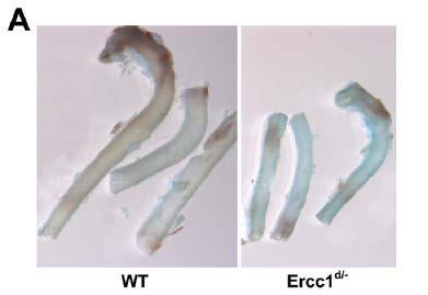 NER and vascular disease ERRC1 d/- vs WT mice Truncated ERCC1 protein senescent vascular cells