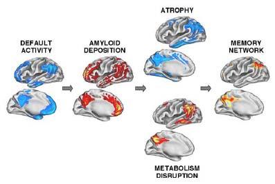 of Brain Pathophysiology of AD
