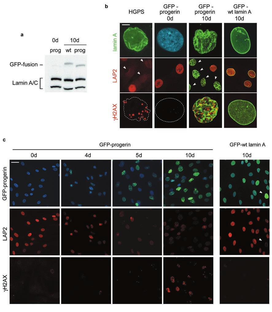 Figure S1 Characterization of tet-off inducible cell lines expressing GFPprogerin and GFP-wt lamin A.