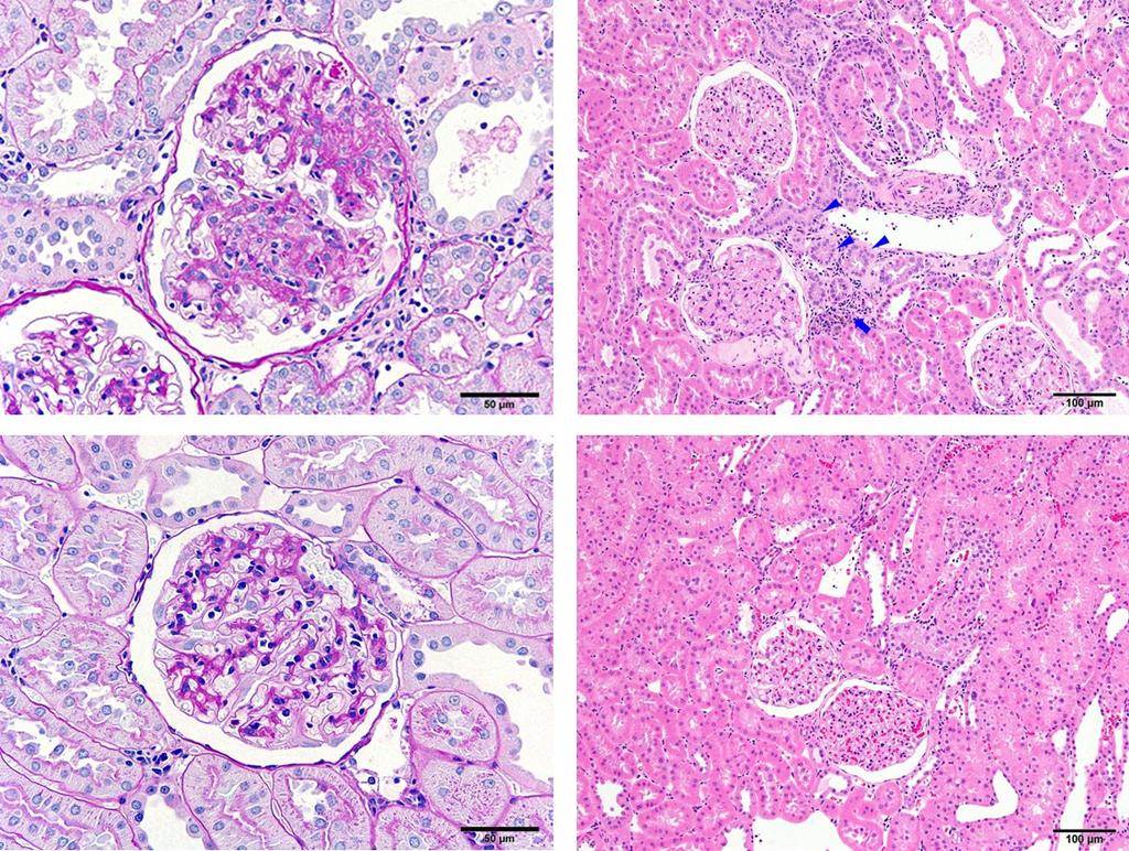 A B C D Figure 4 Photomicrograph of kidney tissues from the 1/2Nx group (A) and (B) and the Control group (C) and (D).