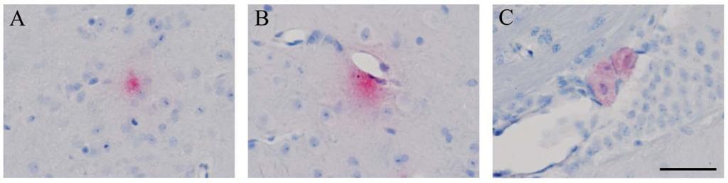 32 Figure 4. C. pneumoniae-specific labeling in the brains of intracranially infected mice These images represent C.
